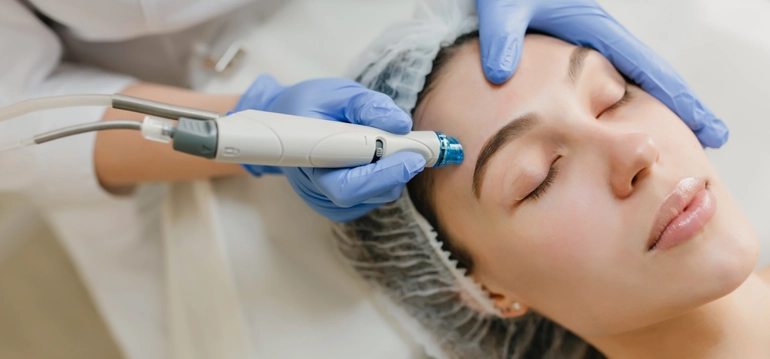 Advanced laser skin treatment for acne scars and pigmentation in Kollam clinic